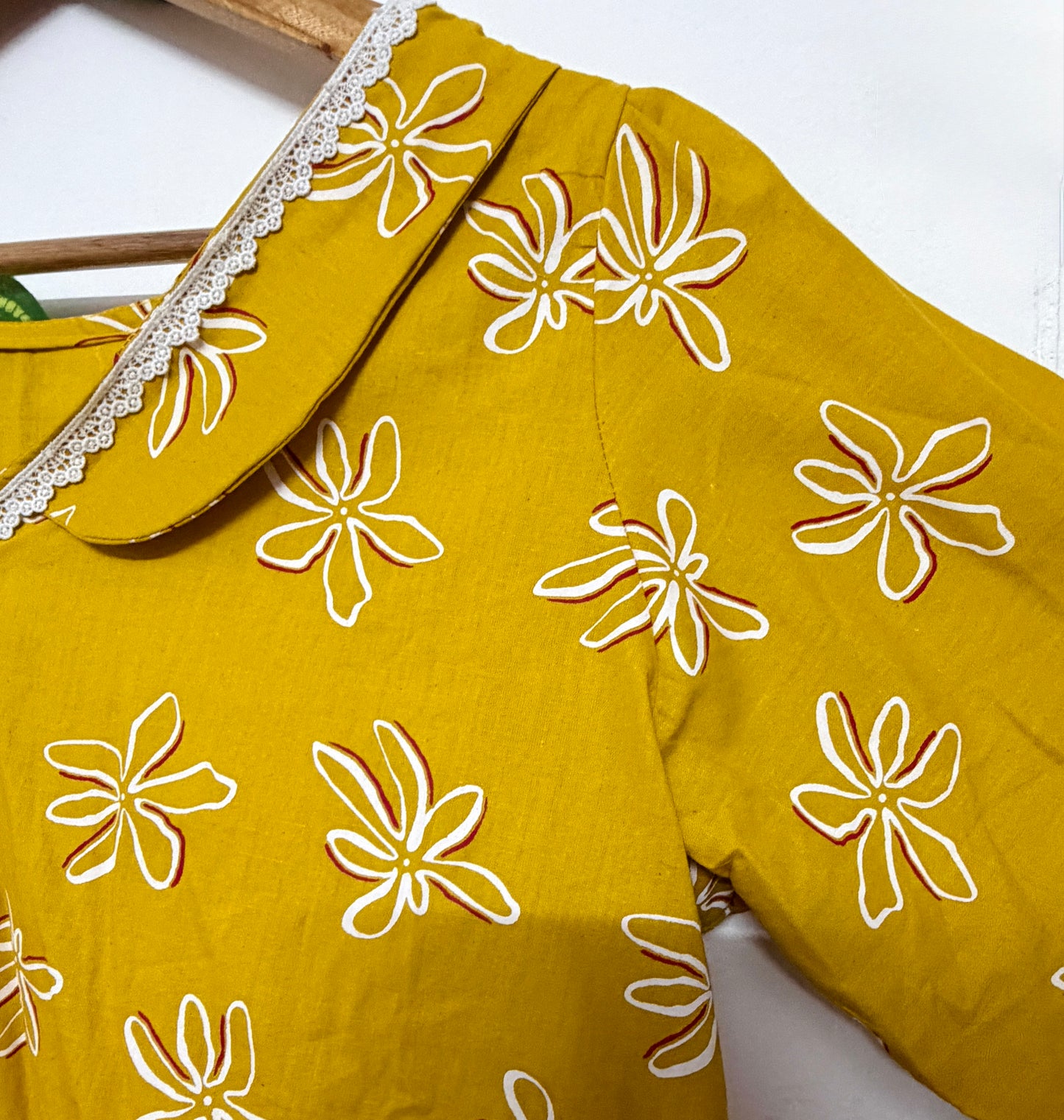 A line feeding dress ✨
