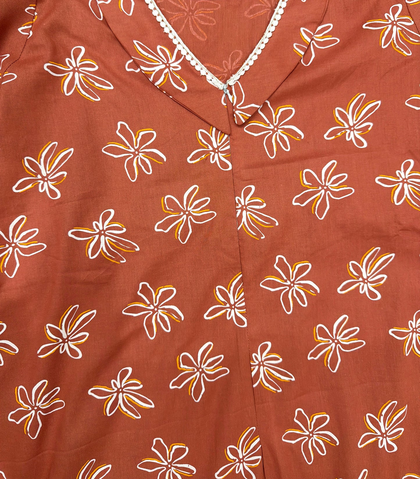Aline feeding dress ✨